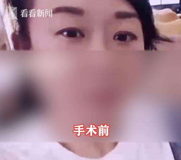 Seperti wanita China lainnya, Jin tidak punya lipatan ganda pada kelopak matanya.
