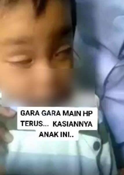 Akibat sering main HP, mata terlihat mengantuk terus