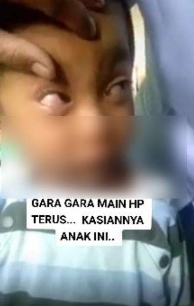 Bagian pupilnya selalu mengarah ke atas.