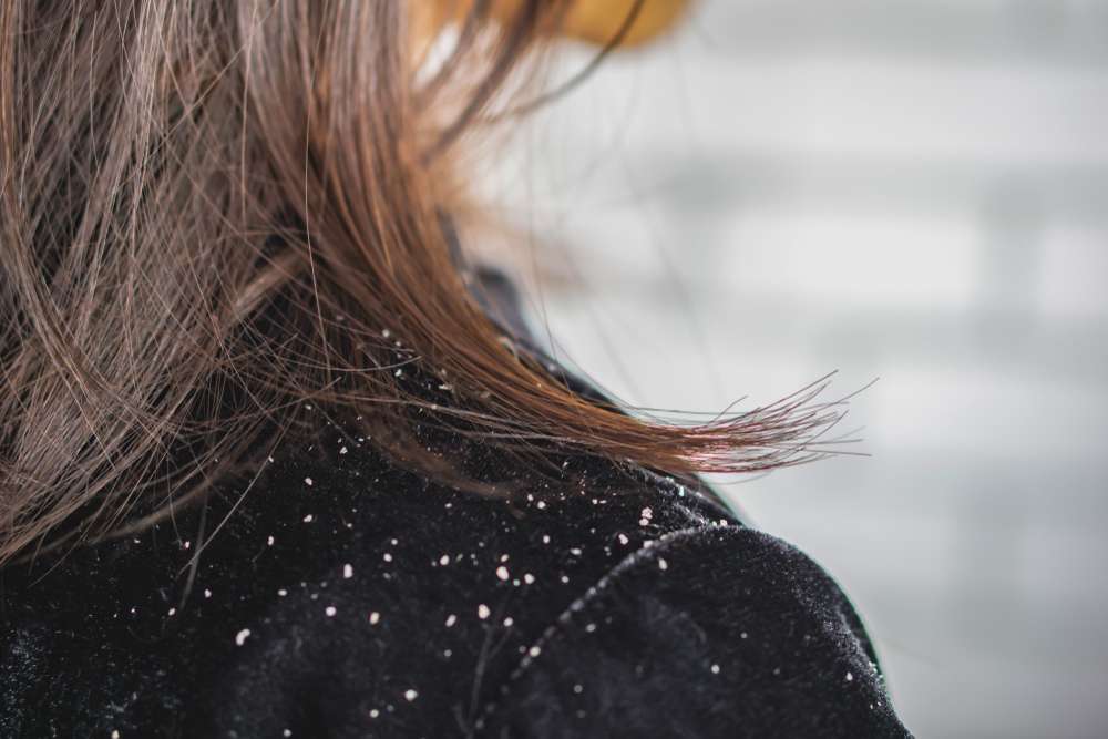 Memiliki Rambut Berketombe
