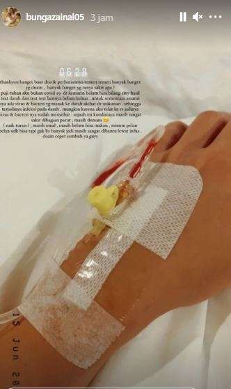 bunga