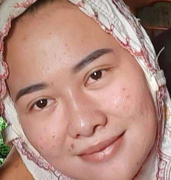 Wajah asli VLH sebelum operasi plastik.