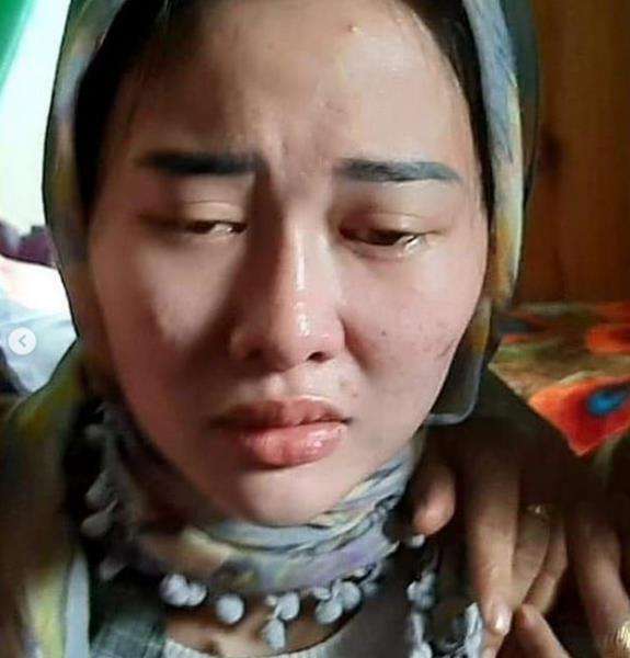 Foto VLH saat masih belum melakukan operasi plastik.