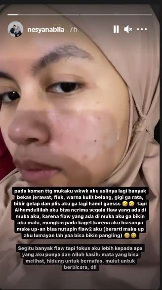 Nesyana istri Ben Kasyafani