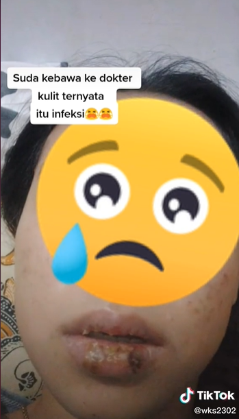 Video Viral