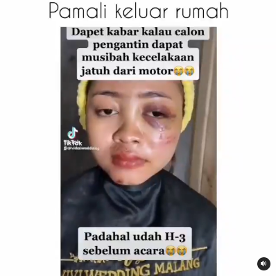 Pengantin Wanita Tetap Makeup Meski Terluka