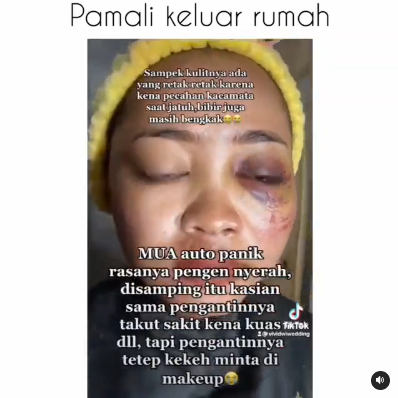 Pengantin Wanita Tetap Makeup Meski Terluka