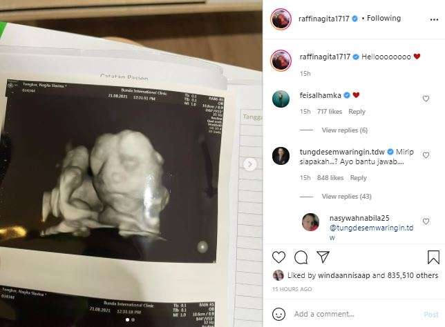 Foto USG anak kedua Raffi dan Nagita.