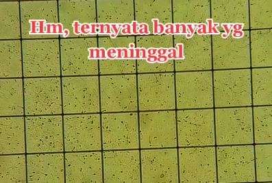 Sperma di bawah mikroskop