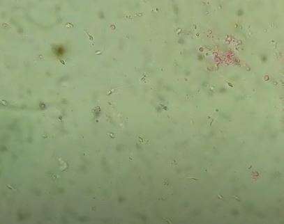 Sel sperma