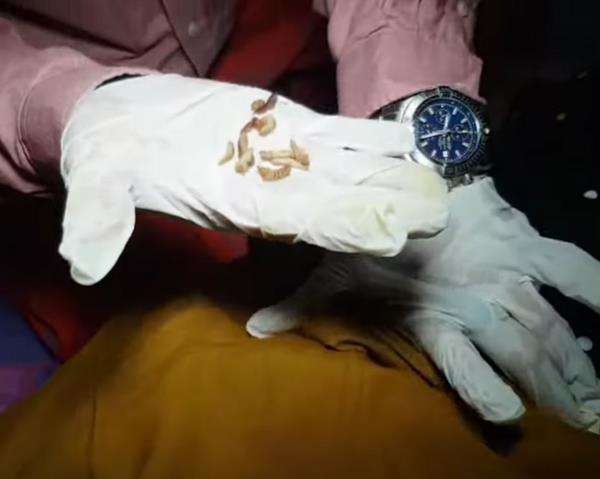 Wanita pelakor kena santet istri sah, keluar belatung setiap kencing.