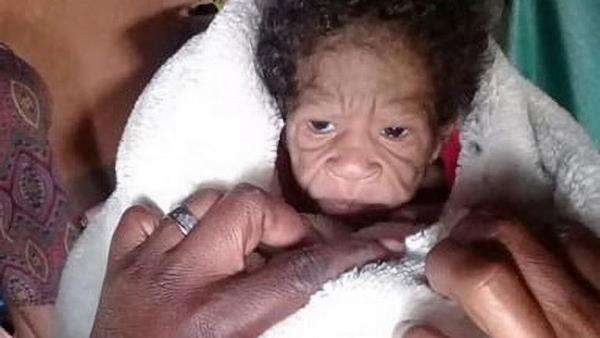 Viral bayi baru lahir kulitnya keriput, tampak lebih tua dari ibunya.