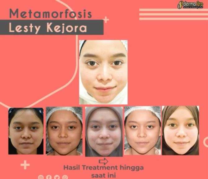 Transformasi Penampilan Wajah