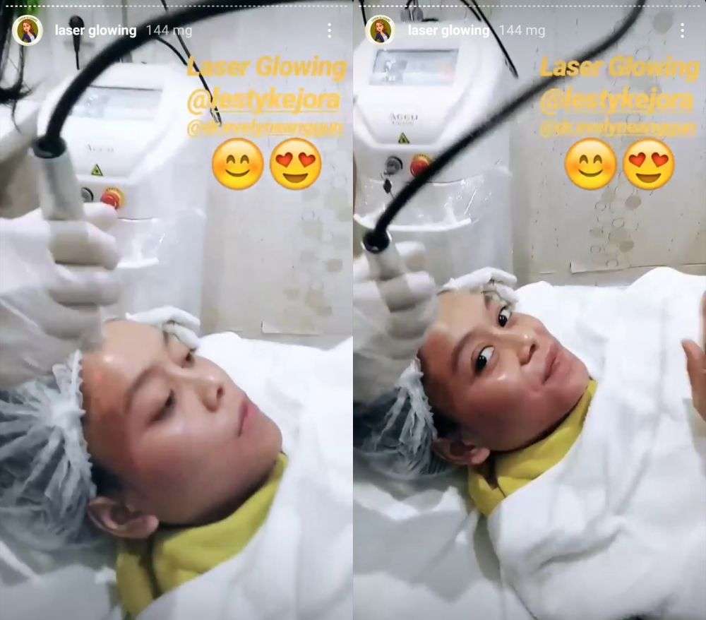 Lesti Kejora Melakukan Perawatan Laser Glowing