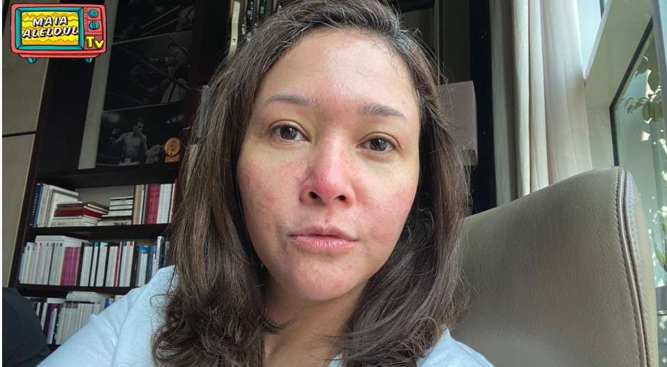 Maia Estianty perlihatkan kondisi wajahnya