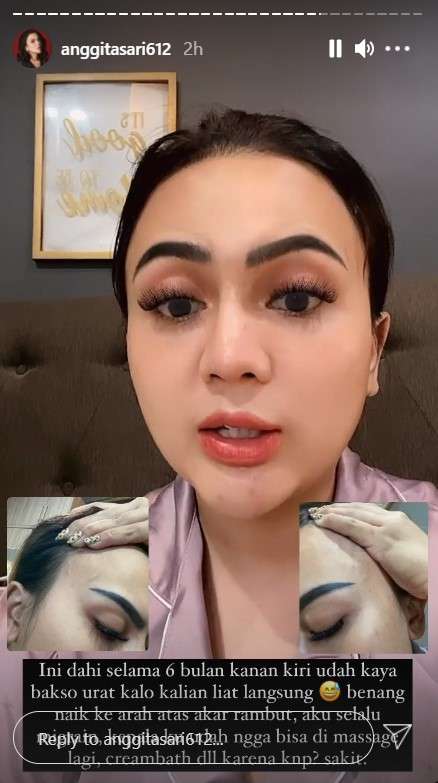 Klarifikasi Anggita Sari soal Malapraktek