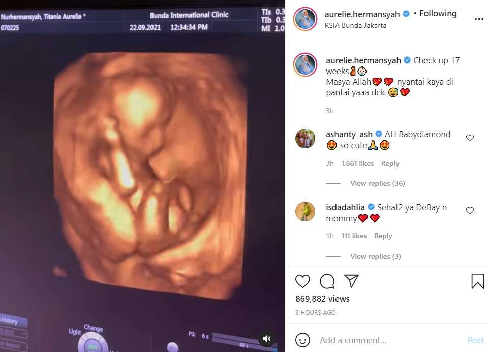 Penampakan calon buah hati Aurel dan Atta