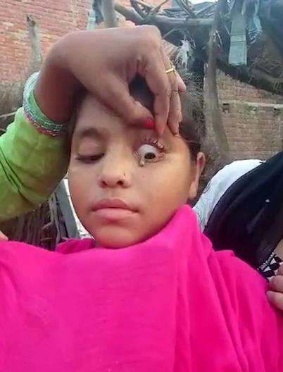 Viral gadis remaja ini 'menangis batu'.