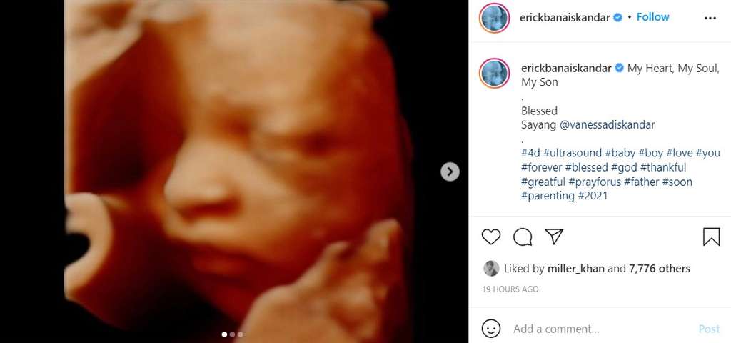 Calon buah hati Erick Iskandar