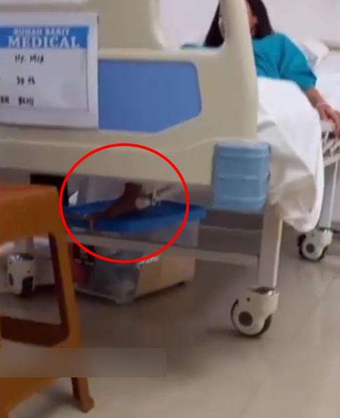 Adegan sinetron kaki diamputasi akhirnya terungkap.