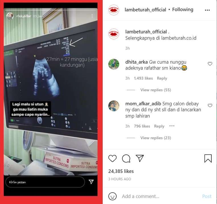 Usia kehamilan Rizky Billar