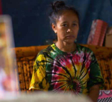 Idap penyakit langka, gadis 16 tahun terlihat seperti wanita 50 tahun