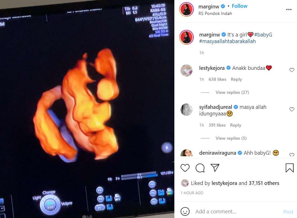 calon buah hati Margin Wieheerm  dan Ali Syakieb