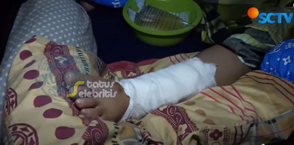 Kondisi bengkak kaki Rohimah