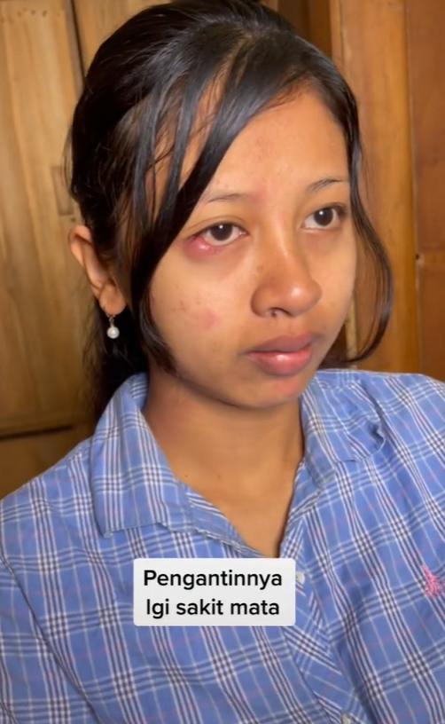 Pengantin Alami Sakit Mata