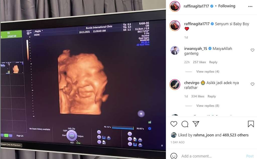 Calon Anak kedua Raffi Ahmad