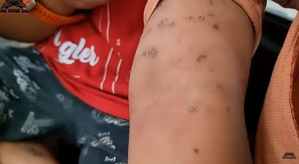 Anak Panji Petualang Digigit Kobra