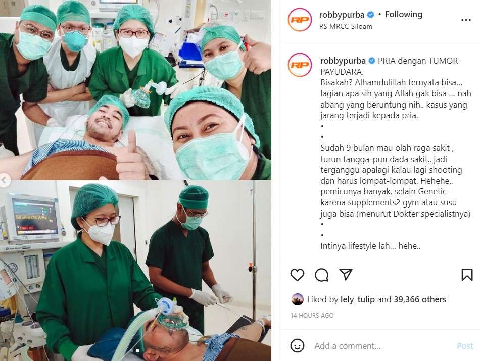 Robby Purba operasi tumor payudara