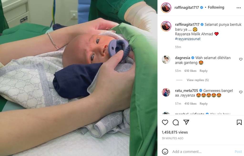 Rayyanza Malik Ahmad disunat