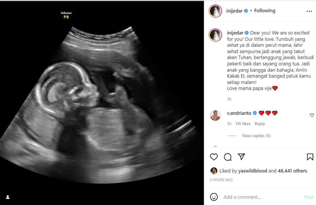 Foto USG calon anak kedua Jedar
