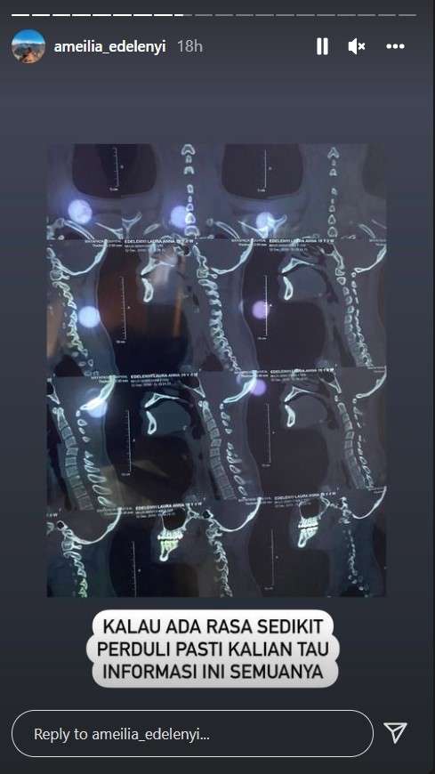 Tanggapan Ibu Laura Anna Tanggapan Ibu Laura Anna