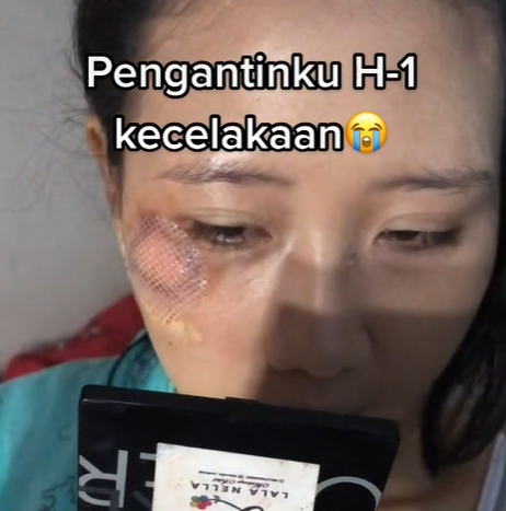 Pengantin Kecelakaan Sebelum Menikah