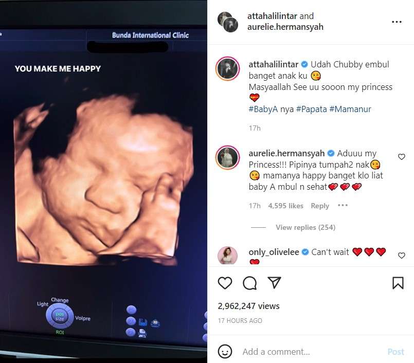 Bayi Atta dan Aurel Hermansyah