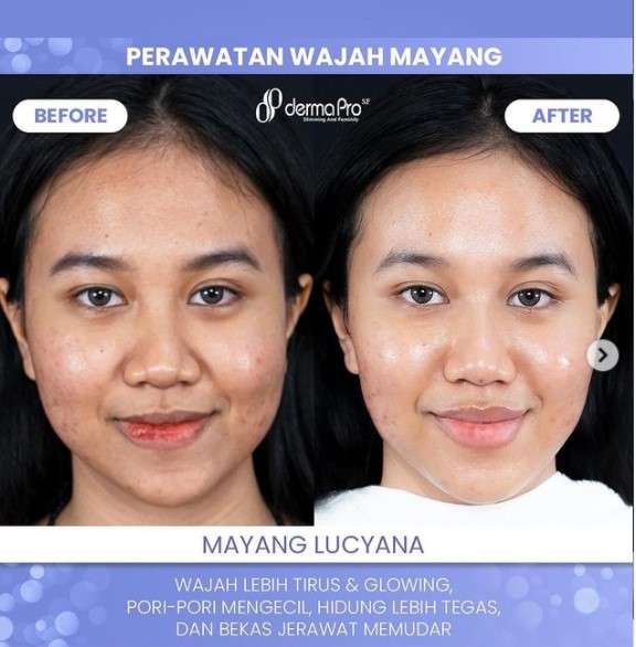 Penampilan Mayang setelah perawatan
