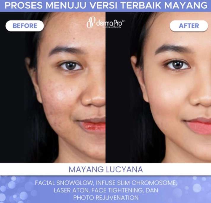 Penampilan Mayang setelah perawatan