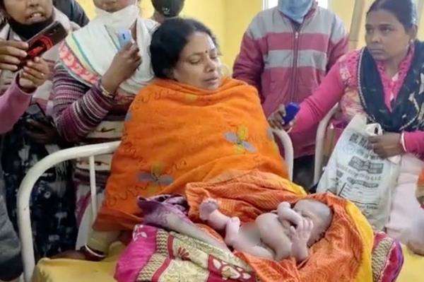 Viral, bayi lahir dengan empat tangan dan kaki dipuja sebagai titisan dewa.