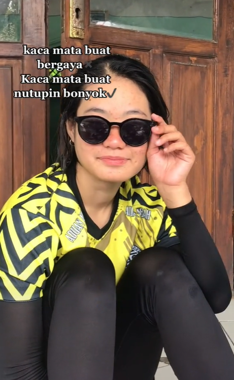 TikTokers Pakai Kacamata Hitam untuk Tutupi Kondisi Mata