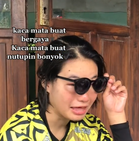 TikTokers Pakai Kacamata Hitam untuk Tutupi Kondisi Mata