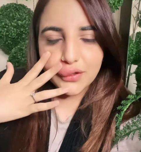 Tak mampu bayar biaya suntik filler lantaran rekening dibekukan, bibir seleb TikTok bengkak