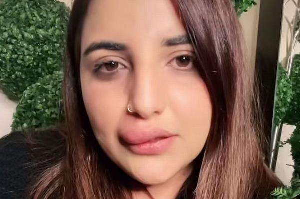 Tak mampu bayar biaya suntik filler lantaran rekening dibekukan, bibir seleb TikTok bengkak