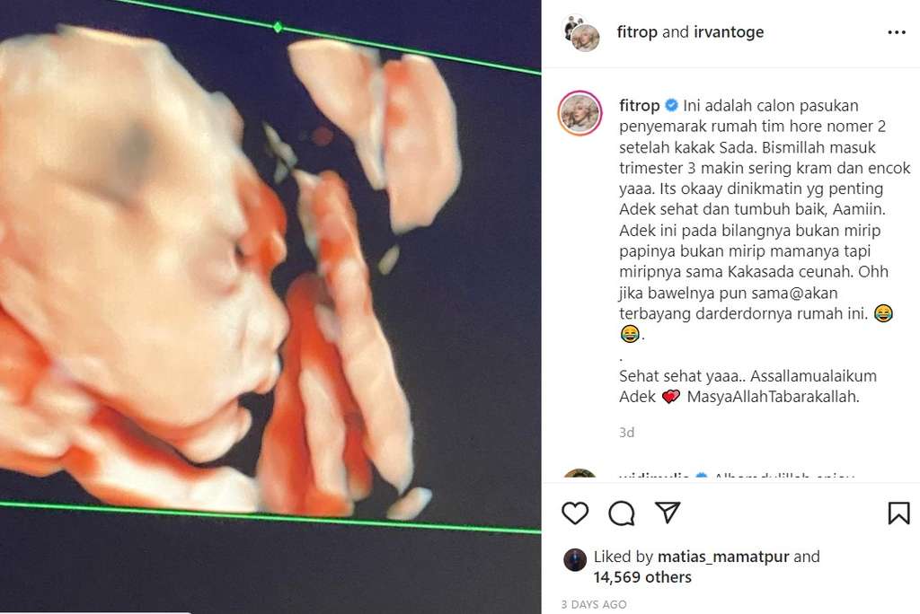 USG calon buah hati kedua Fitri Tropica