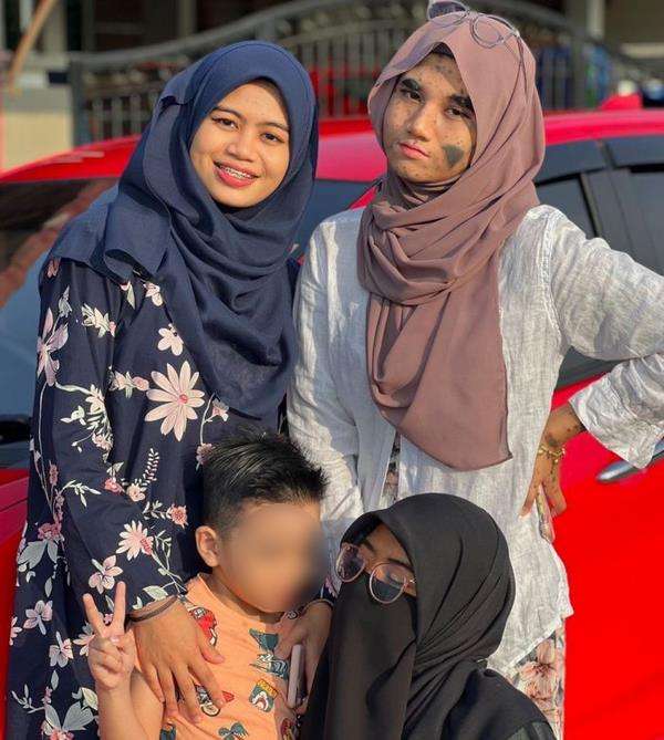 Noda hitam di wajah dikira demi konten.