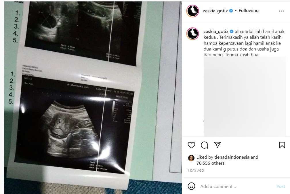 Unggahan Zaskia Gotik hamil anak kedua