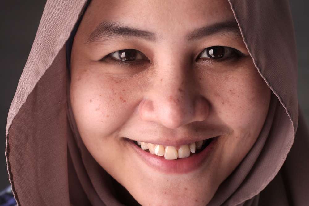 Memiliki Freckles