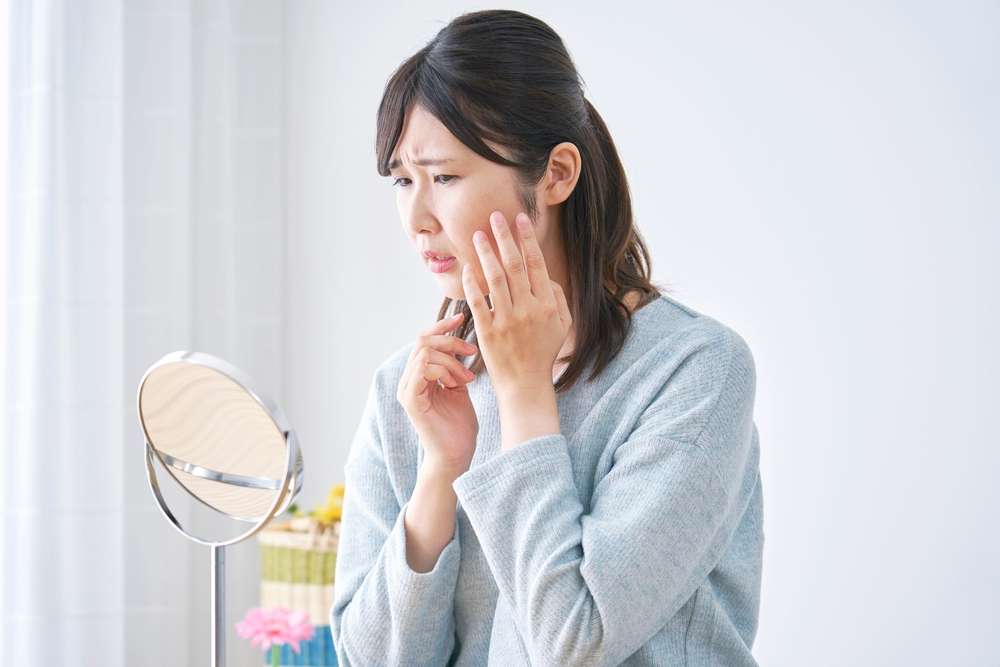 Jangan Diabaikan, Yuk Kenali Tanda-Tanda Hiperpigmentasi Pada Kulit Wajah