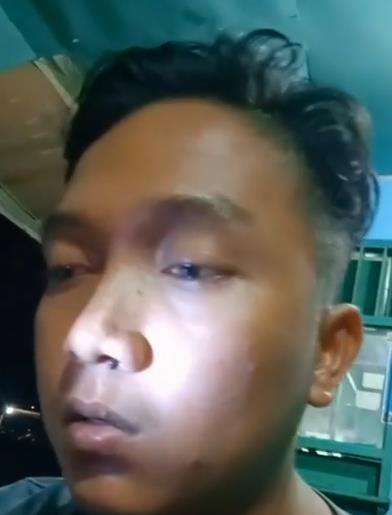 Lintah masuk hidung pemuda.
